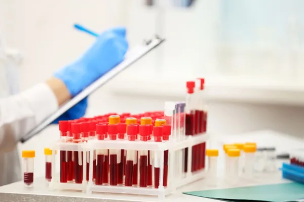 🩸 Що показує загальний аналіз крові: розшифровка показників